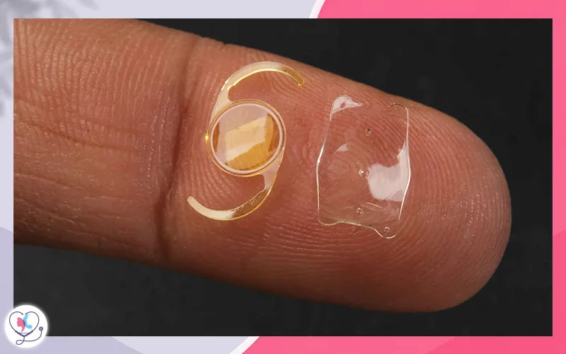ICL - Implantable Collamer Lens