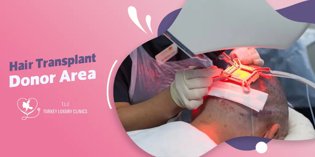 Hair Transplant Donor Area