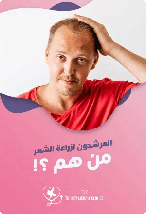من هم المرشحون المثاليون لزراعة الشعر؟featured image