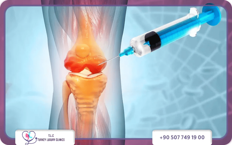 كيفية إجراء حقن الركبة لعلاج الخشونة
