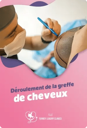 Déroulement de la greffe de cheveux