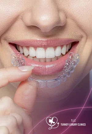 Clear Aligners Cost 2026: At-Home vs In-Office 