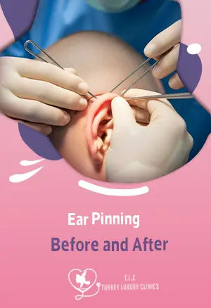 Ear Pinning Before and After: Otoplasty Results & Recovery Real Photos