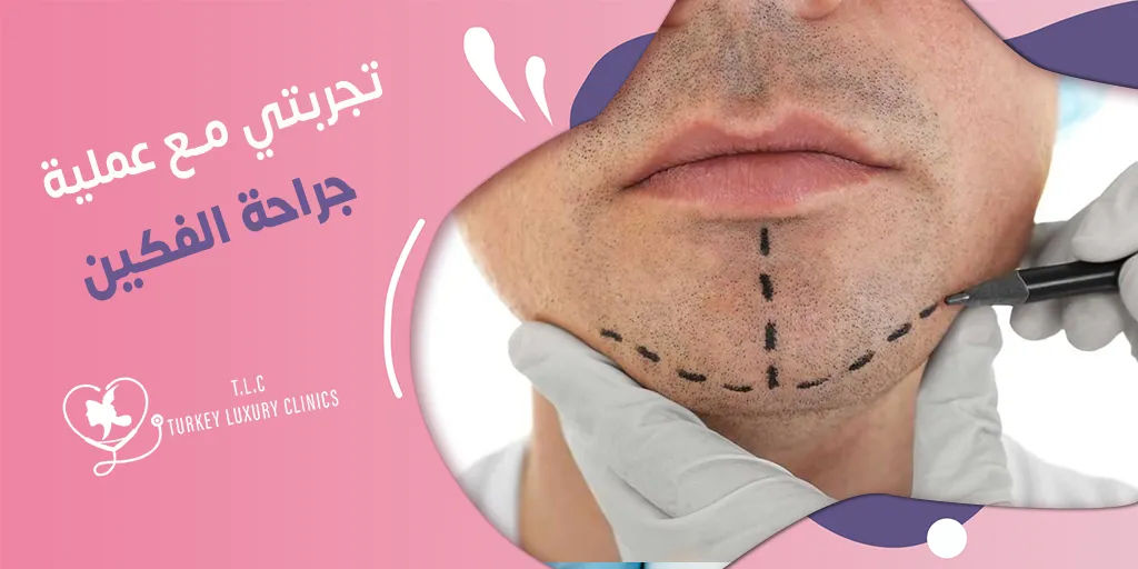 تجربتي مع عملية جراحة الفكين: النتائج بالصور قبل وبعد