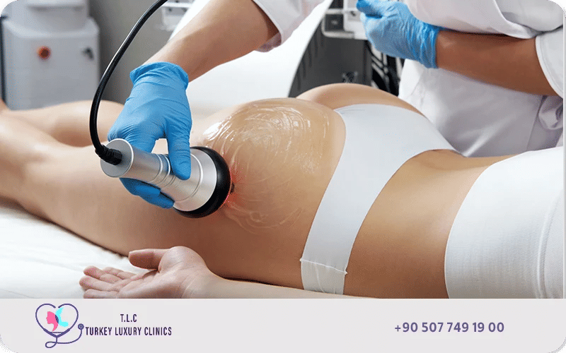 تقنية الجي بلازما (J Plasma)