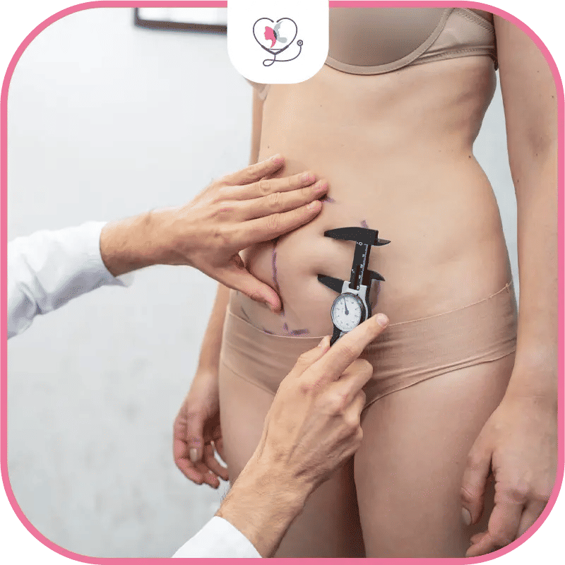 كيف تتم عملية شفط الدهون؟