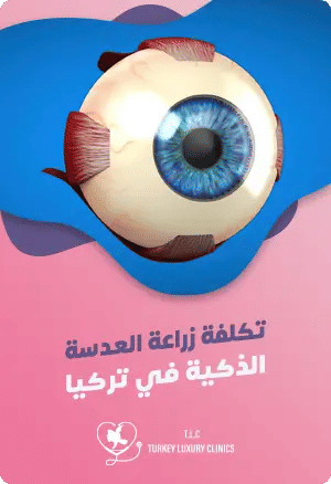 تكلفة زراعة العدسة الذكية في تركيا: فهم التكاليف والمزاياfeatured image