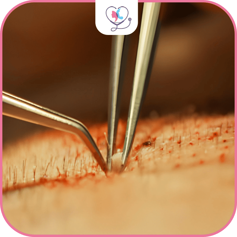 Choose Turkey Luxury Clinics and Rediscover your Beauty!