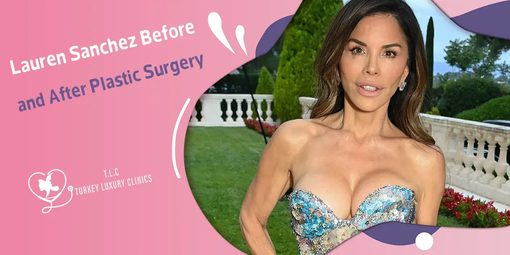Lauren Sanchez Prima e Dopo la Chirurgia Estetica