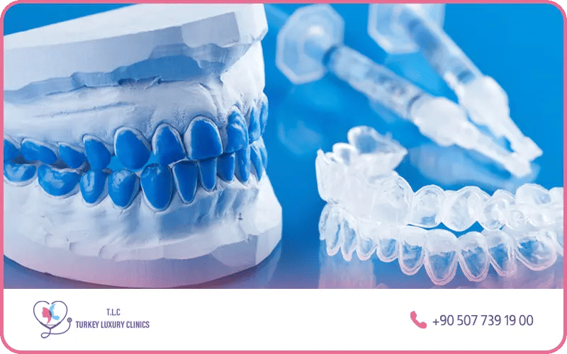 Professional teeth whitening in-office treatment Turkey – laser whitening session cost $300–$1,500 with immediate results
