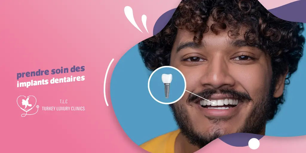 7 conseils pour prendre soin de vos implants dentaires