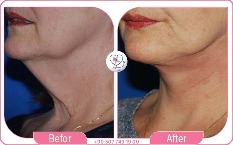 ثانياً: تقنيات حديثة ومعدات متطورة وخدمات متكاملة