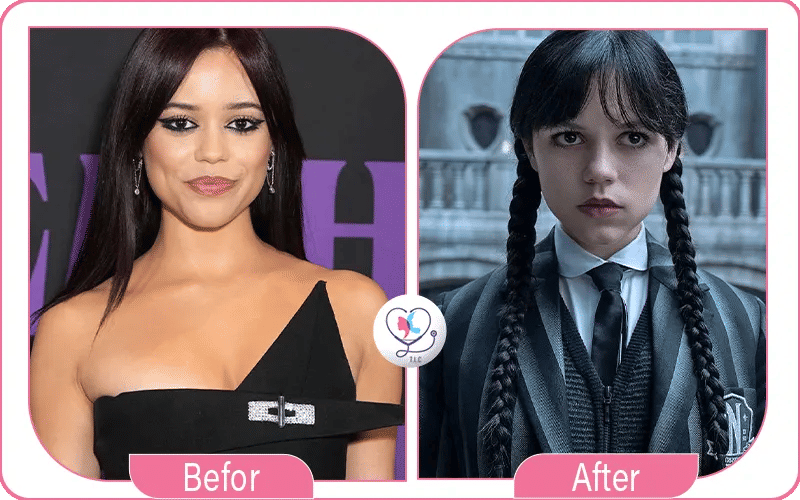 Pourquoi choisir turkey luxury clinic pour une chirurgie esthétique?