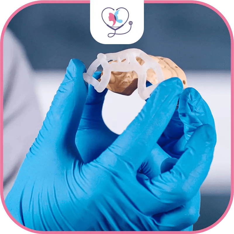 3D Printed Implants in Turkey