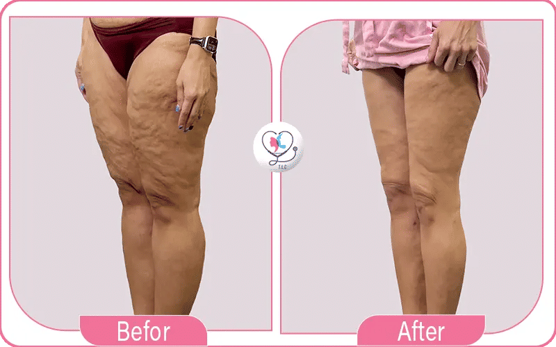 العودة إلى أمريكا