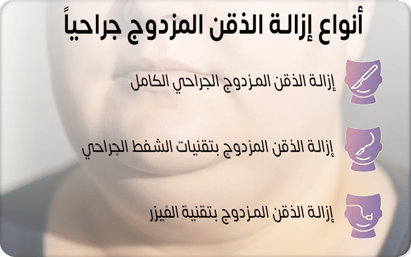 أنواع عمليات إزالة الذقن المزدوج