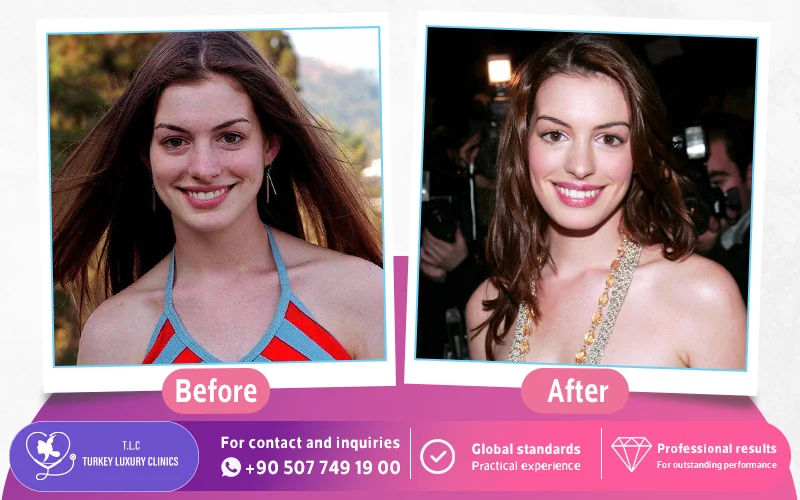 Anne Hathaway 2001 2006