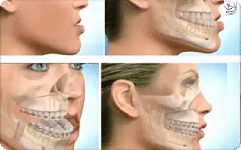 Chirurgie maxillo-faciale à Toulouse