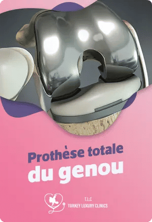 Prothèse totale du genoufeatured image