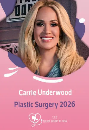 Carrie Underwood Plastische Chirurgie 2026: Unfall, Genesung & Eingriffefeatured image