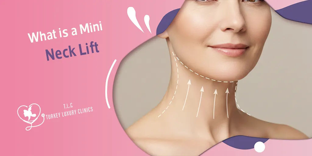 Mini Lifting del Collo: Costi, Benefici e Risultati