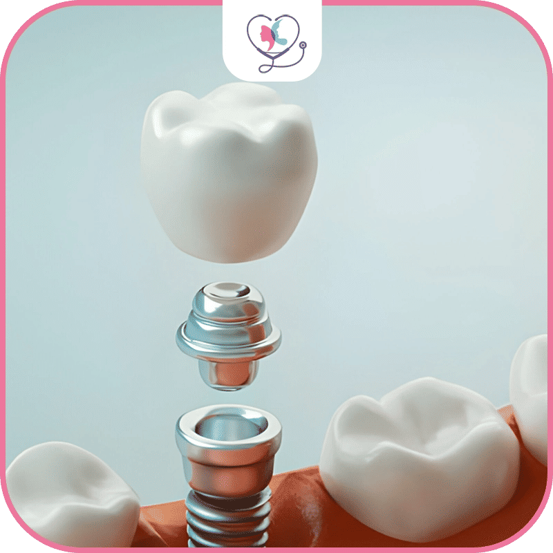 problèmes-potentiels-de-cicatrisation-après-une-chirurgie-buccale