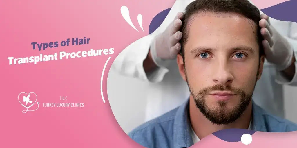 Arten von Haartransplantationsverfahren