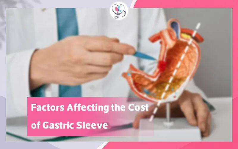 Factors Affecting the Cost of Gastric Sleeve