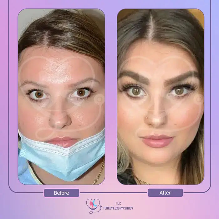 galerie-de-nos-résultats-en-gros-plan-2