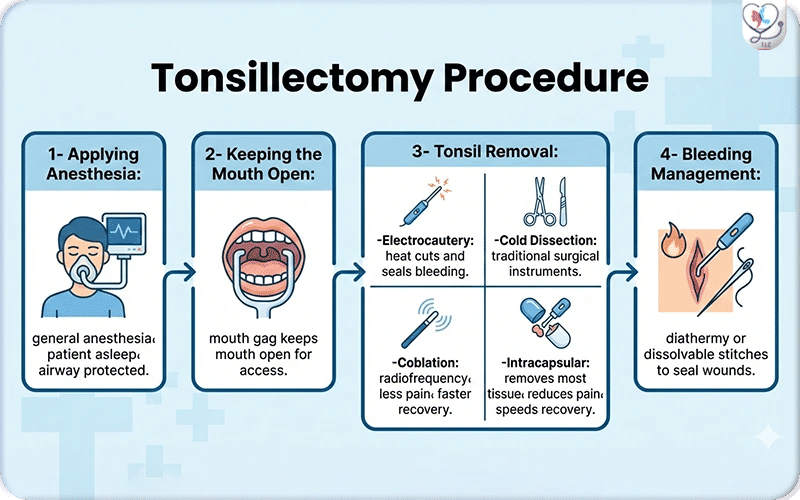 How to Prepare for Tonsillectomy