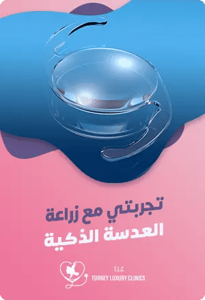 تجربتي مع زراعة العدسة الذكيةfeatured image
