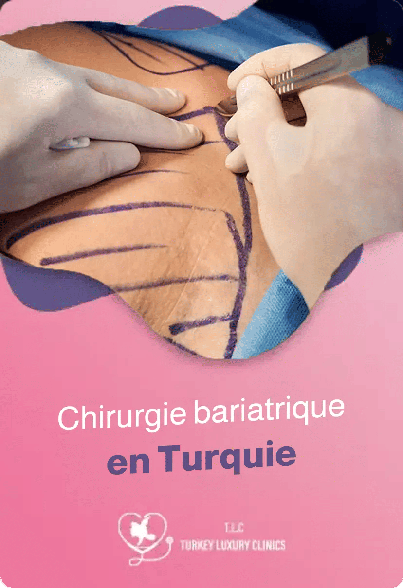 Chirurgie bariatrique en Turquie : Prix, procédures et avantages