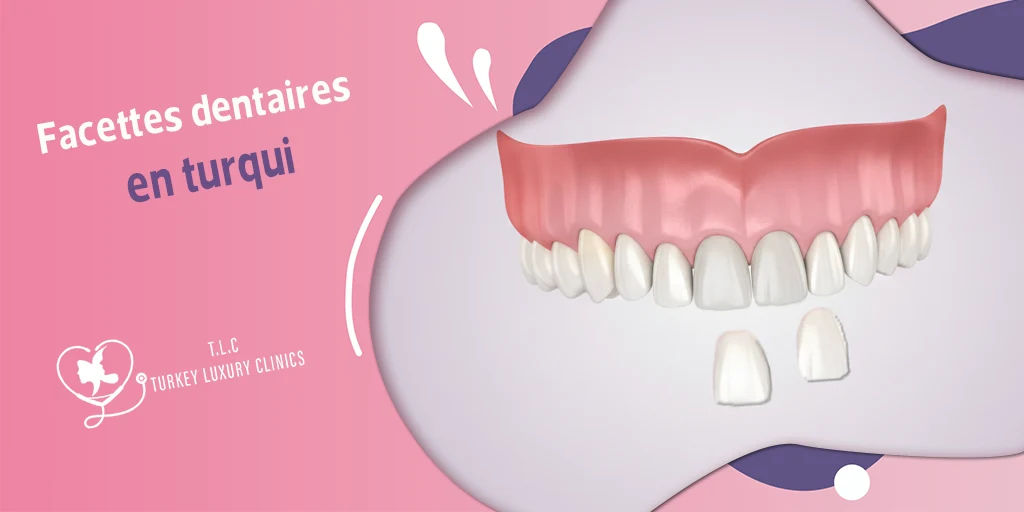 Facettes dentaires en turqui : Types, Prix, Avantages et Avis Patients