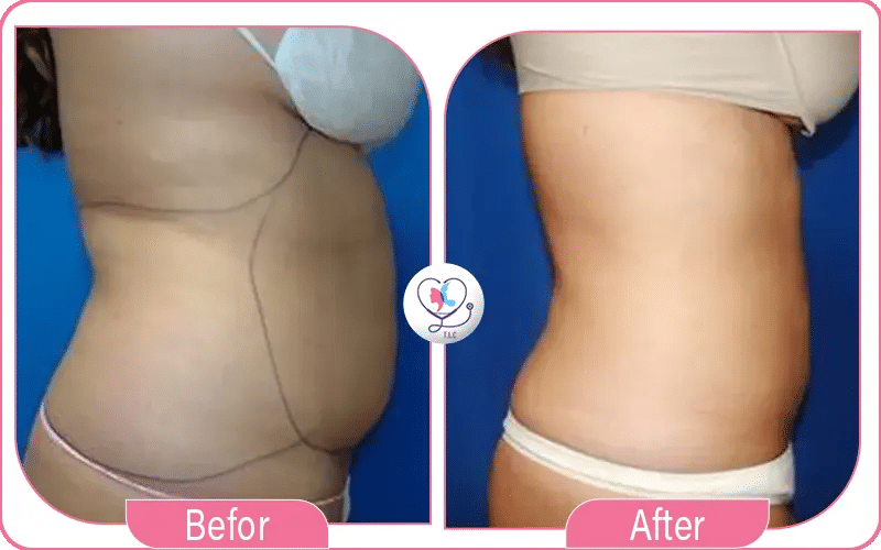 ثالثاً: ما بعد العملية