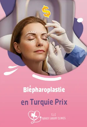 Blépharoplastie en Turquie Prix : Avis Patients et Packages Turkey Luxury Clinic