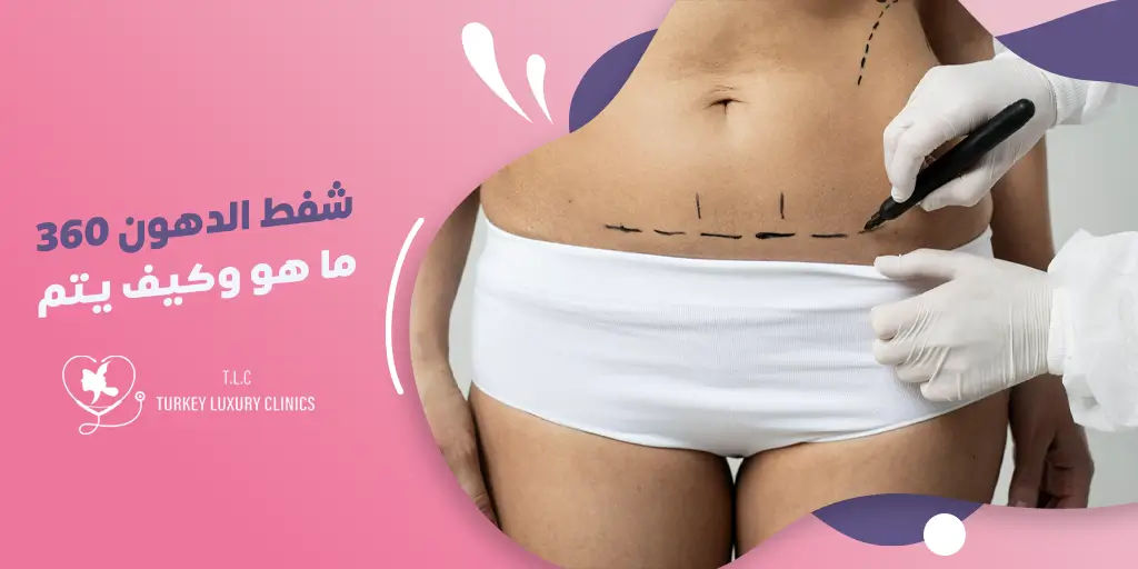 شفط الدهون 360 درجة: ما هو وكيف يتم؟