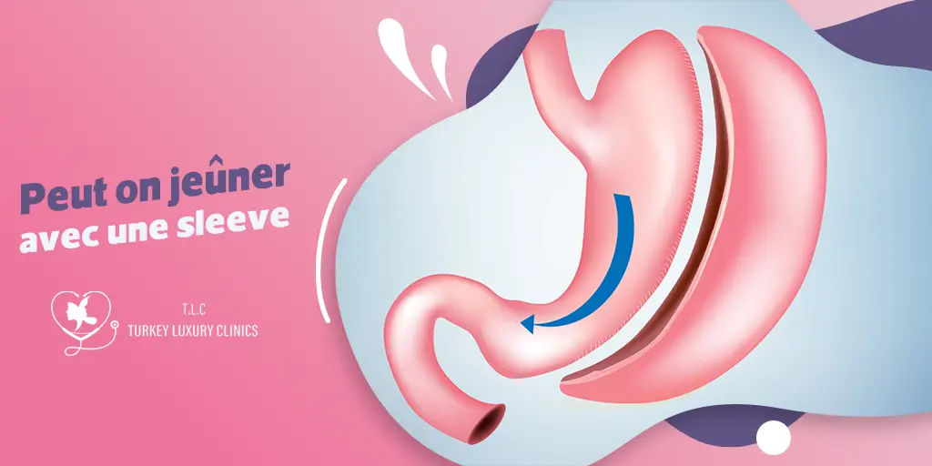 Peut on jeûner avec une sleeve : Conseils et précautions