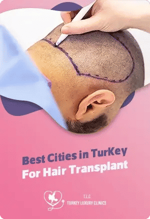 Лучшая клиника трансплантации волос в Турции: Turkey Luxury Clinics