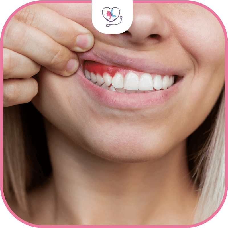 أمراض اللثة