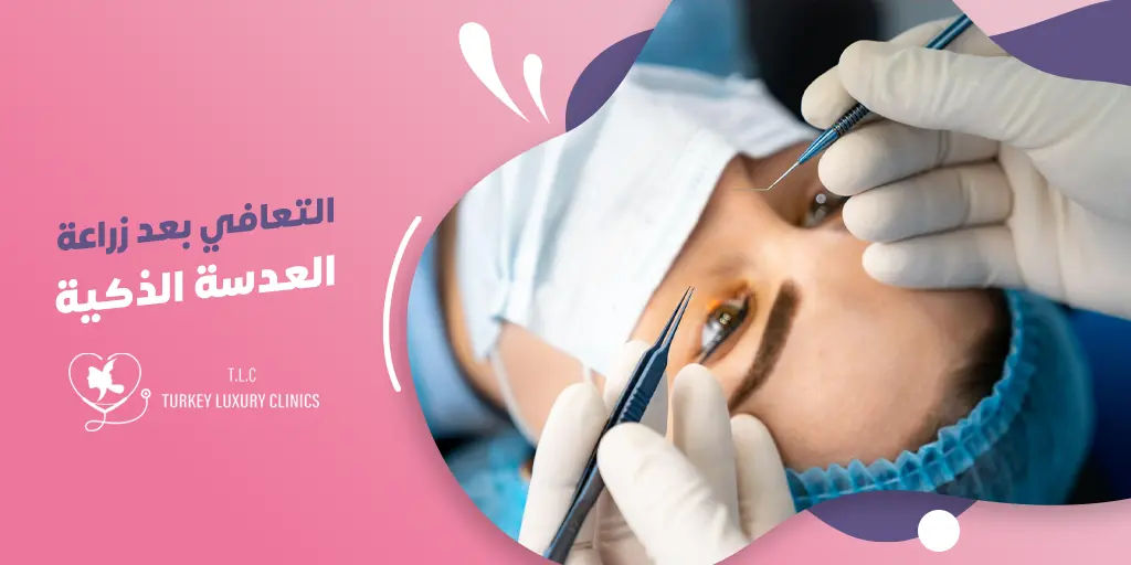 التعافي بعد زراعة العدسة الذكية: الحياة بعد العملية