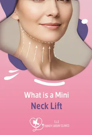 What is a Mini Neck Lift: Cost, Benefits, Before & After