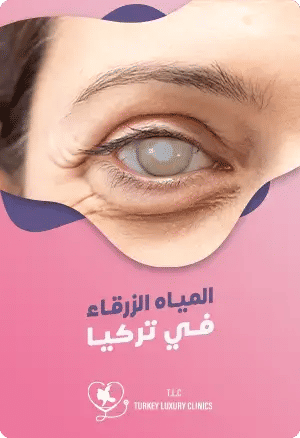 عملية المياه الزرقاء في تركياfeatured image