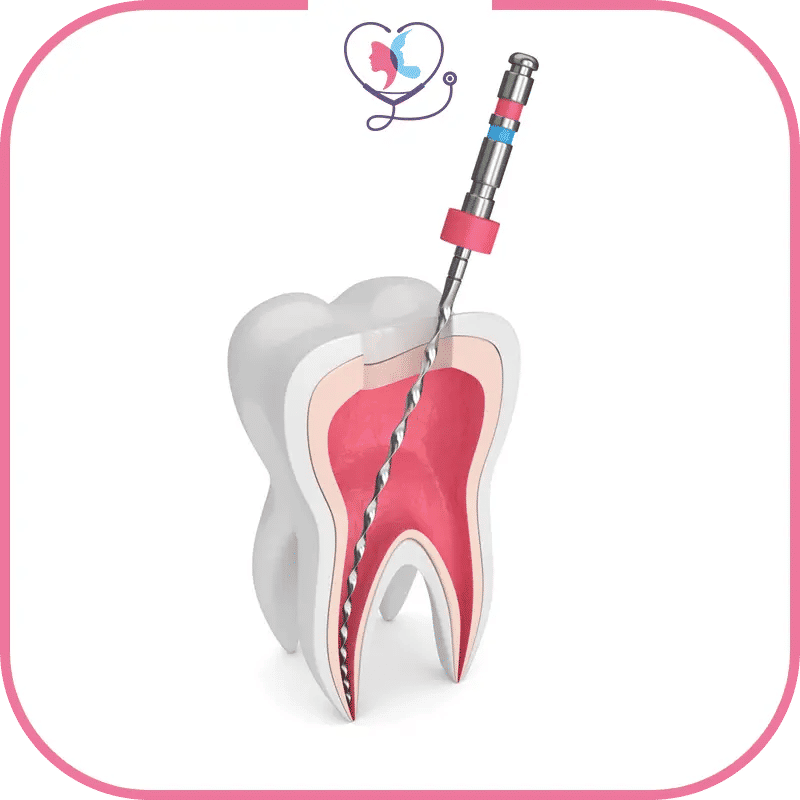 ماهي أسعار العلاجات اللبية في تركيا؟