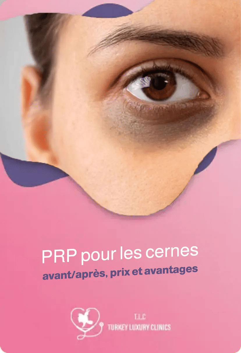 PRP pour les cernes : avant/après, prix et avantages