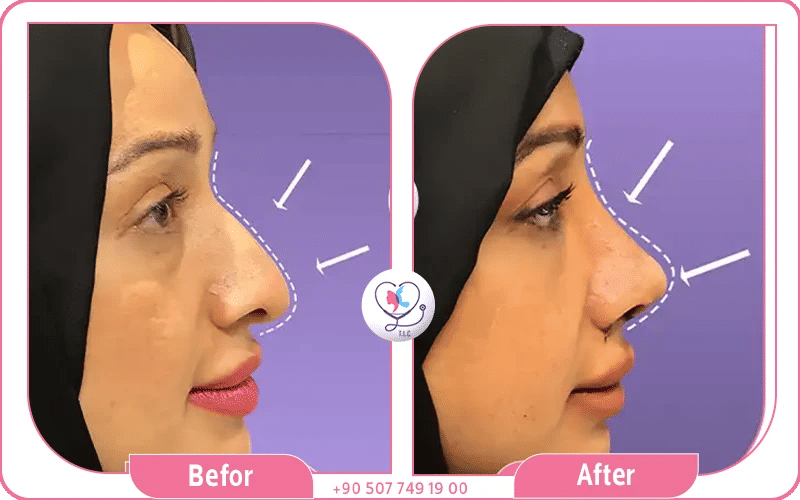 3. التوصيات والتقييمات