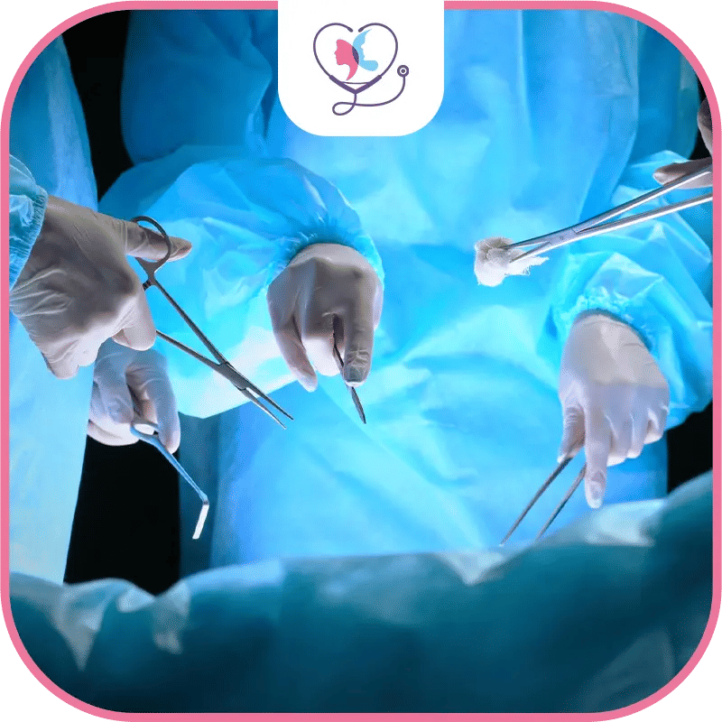 خطوات عملية تحويل المسار المصغر