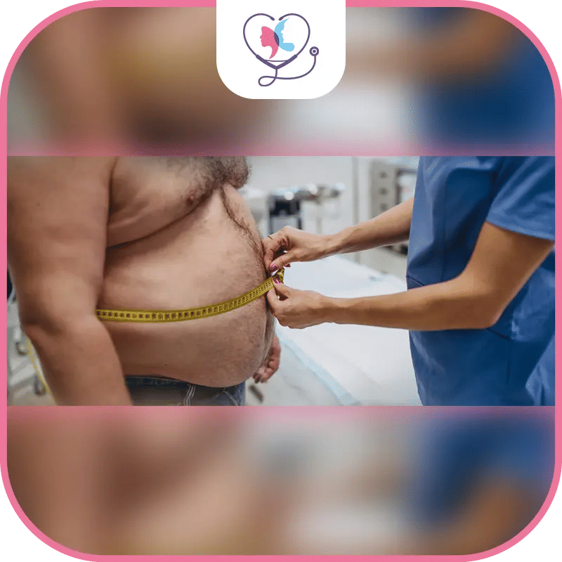 Diet After Gastric Sleeve Surgery