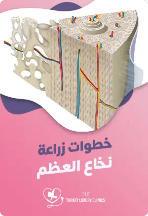 ما هي خطوات زراعة نخاع العظم؟featured image