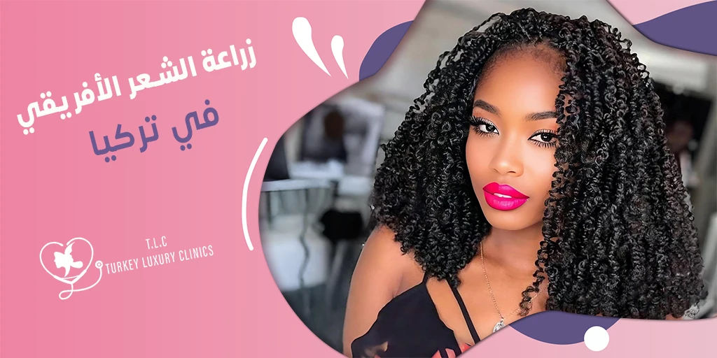 زراعة الشعر الأفريقي في تركيا: التقنيات مع نسب النجاح والتكلفة