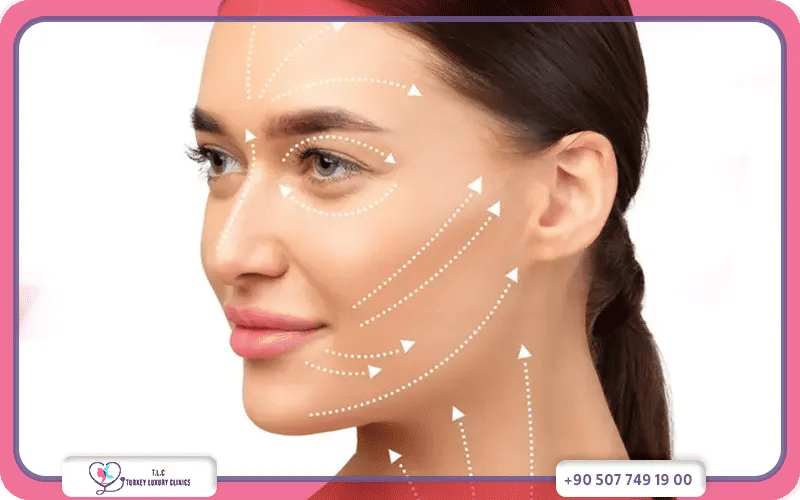 كم تكلفة شد الوجه في تركيا؟